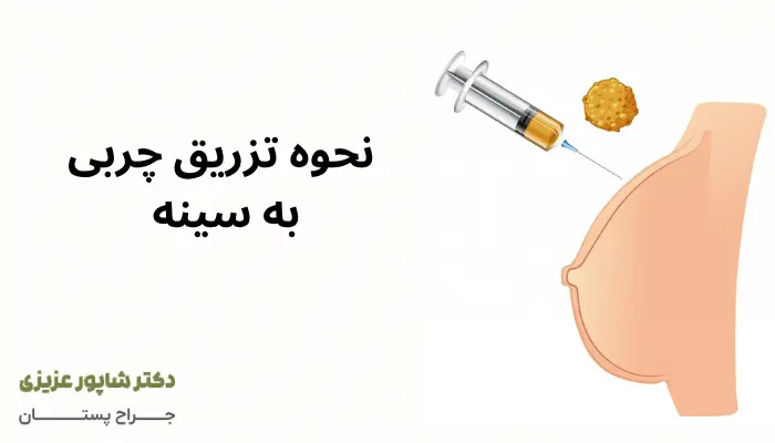 نحوه تزریق چربی به سینه