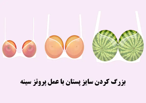 بزرگ کردن سایز پستان