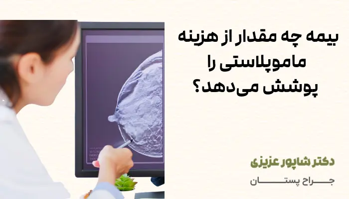 بیمه چه مقدار از هزینه ماموپلاستی را پوشش می‌دهد؟