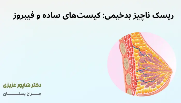 ریسک ناچیز بدخیمی: کیستهای ساده و فیبروز