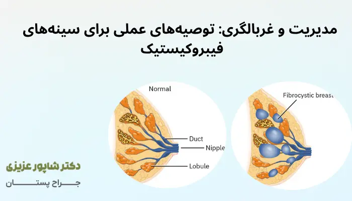 مدیریت و غربالگری: توصیههای عملی برای سینههای فیبروکیستیک