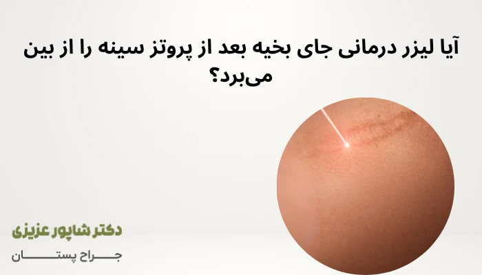 آیا لیزر درمانی جای بخیه بعد از پروتز سینه را از بین میبرد؟ آیا لیزر درمانی جای بخیه بعد از پروتز سینه را از بین میبرد؟