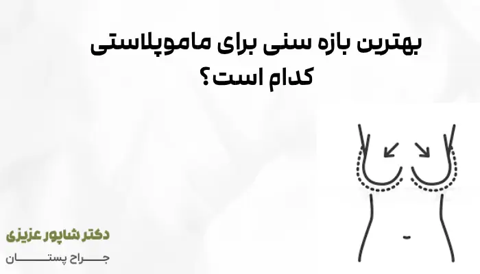 بهترین بازه سنی برای ماموپلاستی کدام است؟