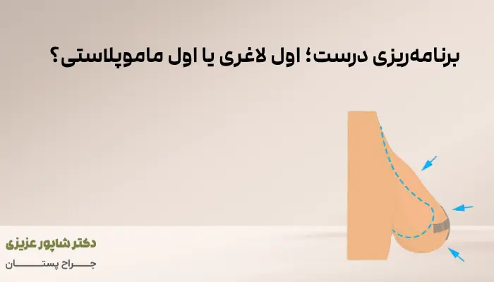برنامهریزی درست؛ اول لاغری یا اول ماموپلاستی؟