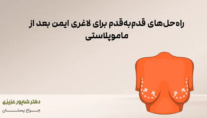 راهحلهای قدمبهقدم برای لاغری ایمن بعد از ماموپلاستی