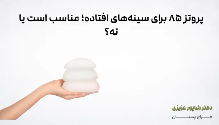 پروتز ۸۵ برای سینههای افتاده؛ مناسب است یا نه؟